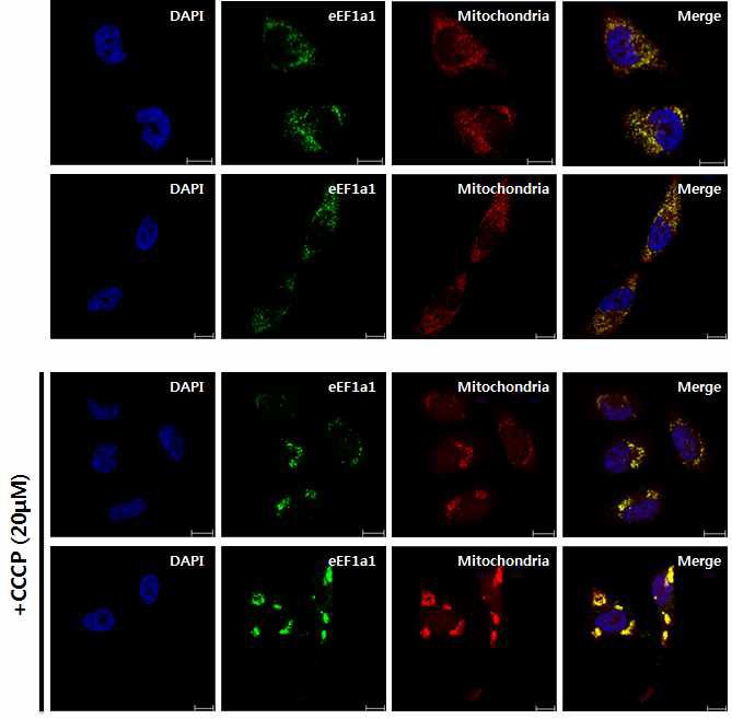 그림 16 mitophagy유도 시 eEF1A1의 미토콘드리아로의 translocalization