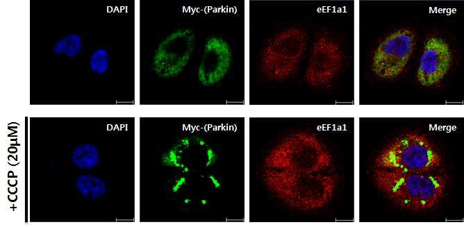 그림 17 mitophagy유도 시 Parkin과 eEF1A1는 mitochondria에서 co-localization