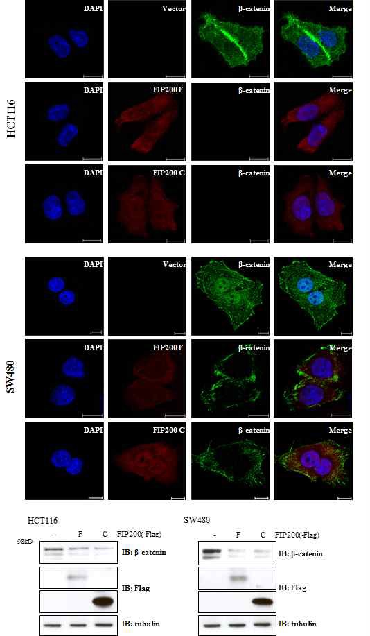 그림 21 HCT116 및 SW480 세포주에서의 FIP200에 의한 β-catenin 조절