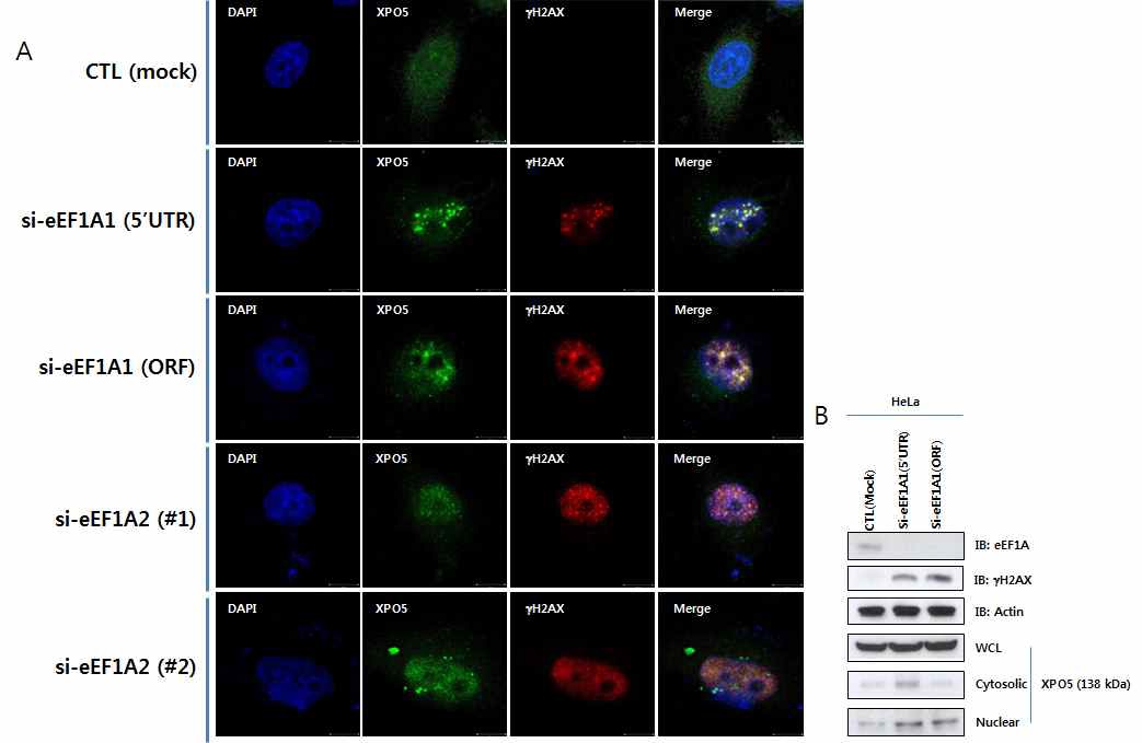 그림 25 eEF1A family의 knockdown을 통한 XPO5의 핵 내 축적 증가