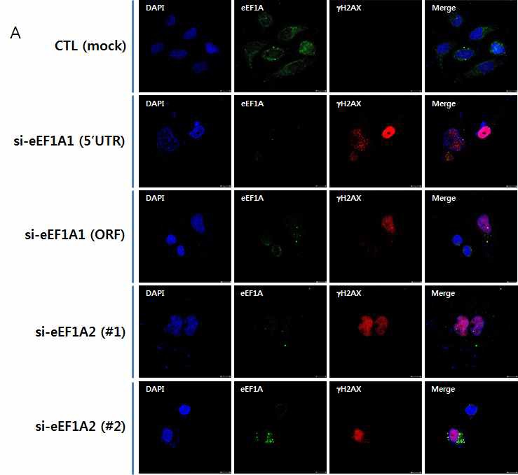 그림 27 eEF1A family의 knockdown에 의한 DNA 손상 신호 유도