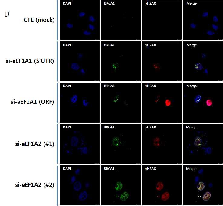 그림 29 γH2AX foci로의 BRCA1 및 53BP1의 소집