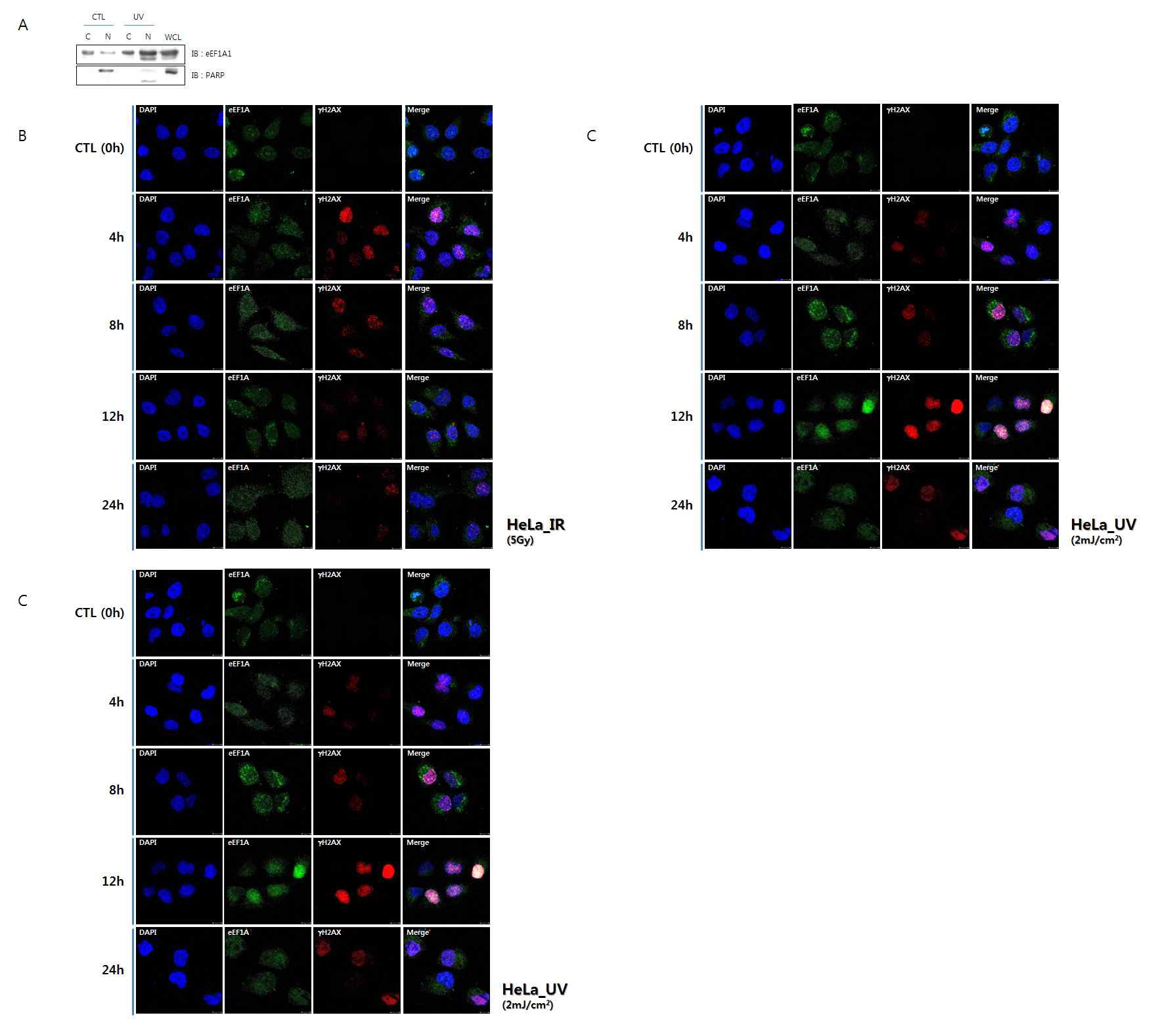 그림 30 DNA damage 유도시 eEF1A family (A1 & A2)의 핵 내로의 소집