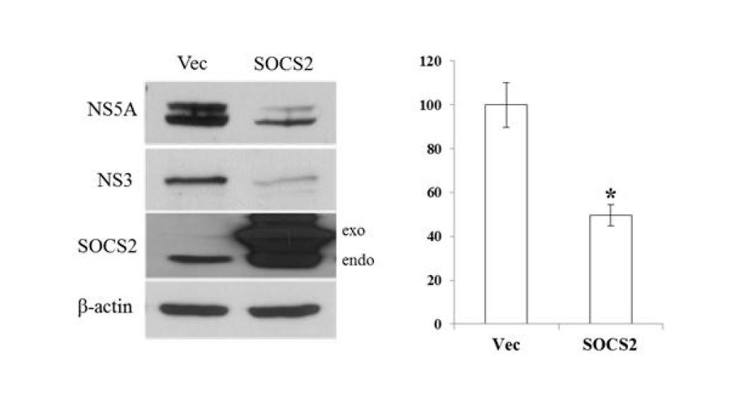 SOCS2 과발현은 C형간염바이러스 증식을 억제함.