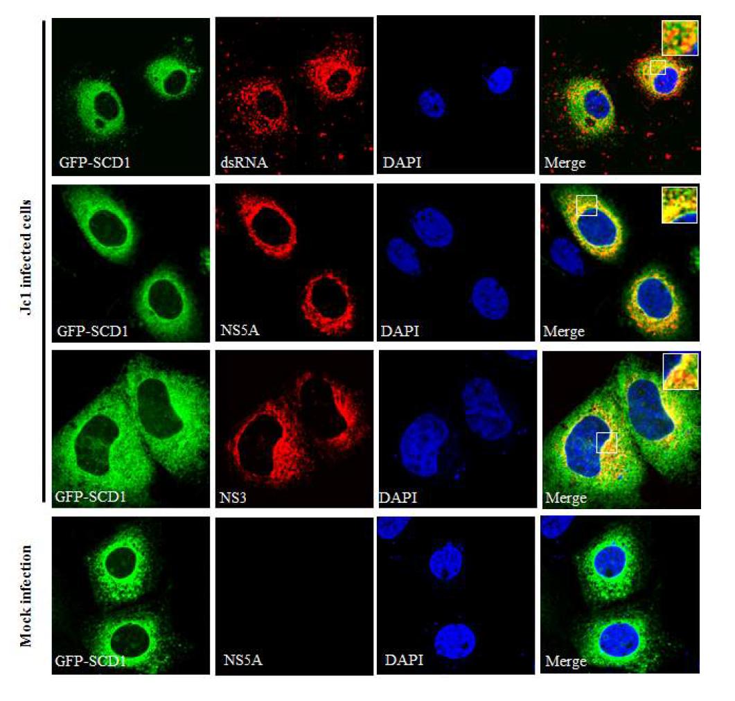 SCD1과 dsRNA 및 비구조단백질과의 colocalization.