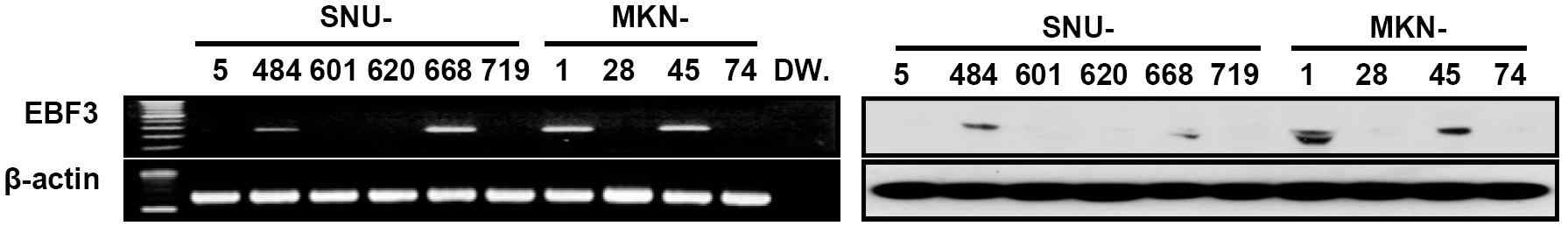 그림 11. 위암 세포주에서의 EBF mRNA and protein 발현