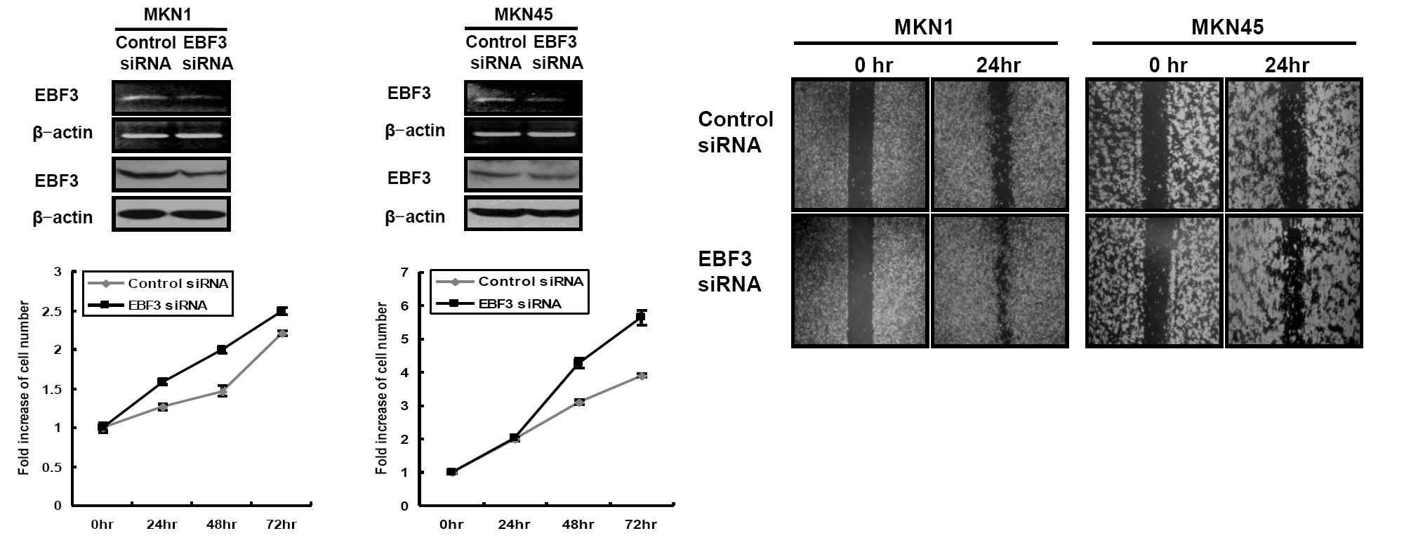 그림 14. EBF3 siRNA 주입에 의한 세포의 증식과 세포의 이동능력
