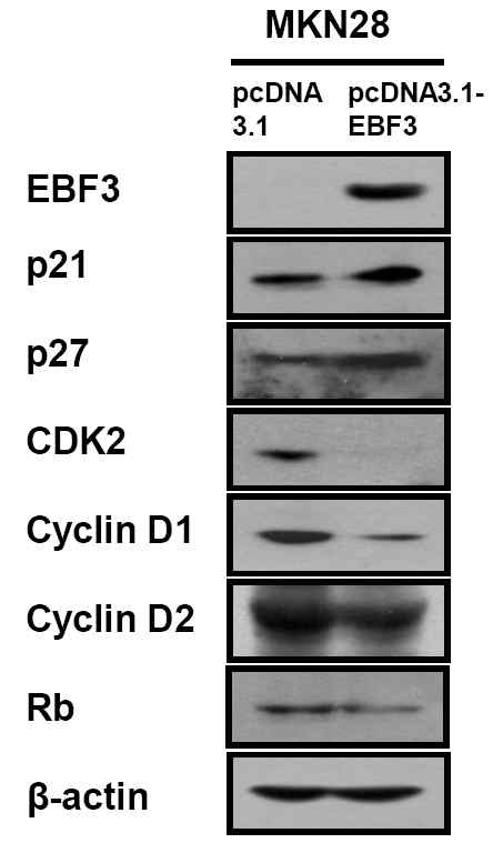 그림 16. EBF 유전자 주입에 의한 세포주기 관련 단백의 발현 변화