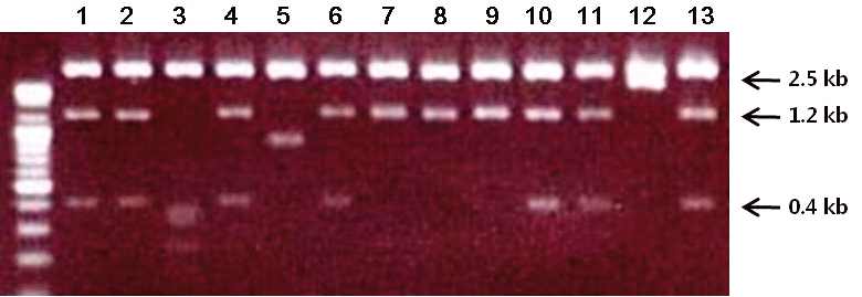 그림 20. 13개 클론을 EcoRI과 NotI으로 절단후 전기영동한 결과 3 가지 서로 다른 길이로 되어 있었으며, 이 들의 염기서열을 분석하였음