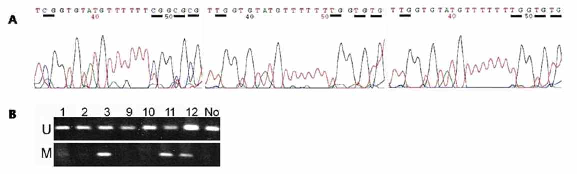 그림 24. GPX1 유전자의 promoter hypermethylation 검사 (위)와 GPX3 유전자의 methylation specific PCR 검사 (아래)