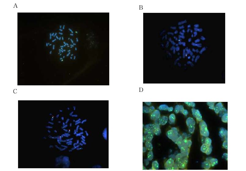 그림 18. A. Normal blood (10 x 100), B. SNU719 (10 x 100), C. SNU484 (10 x 100), D. Gastric cancer