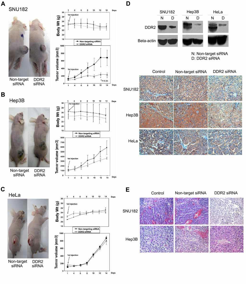 Intratumoral injection of DDR2 siRNA inhibits tumor growth in HCC xenograft model. DDR2 siRNA or non-target siRNA was injected into the tumors on scheduled days for 6 times (1, 4, 6, 8, 10, and 12 days). (a) There was a significant difference in average tumor volumes between the DDR2 siRNA-treated group and the non-target siRNA-treated group at 12 days and at 14 days after the injection (P < 0.05) in SNU182 xenograft mice. DDR2 siRNA injection decreased the mean tumor volume by 65.6% compared to that of the control. (b) Hep3B xenograft mice did not demonstrate any significant difference in tumor growth after DDR2 siRNA or non-target injection. (c) Negative control, HeLa cells showed no differences in average tumor volume between DDR2 siRNA and control injection. (d) At the end of study, harvested tumor tissues from the sacrificed mice demonstrated suppressed expression of DDR2 protein by DDR2 siRNA in Western blot (upper) and in immunohistochemical staining with anti-DDR2 antibody (lower). (e) Histology (H&E stain) of SNU182 and Hep3B xenograft tumors in non-treatment (control), after non-target siRNA treatment, and after DDR2 siRNA treatment showed a change of tumor tissue.