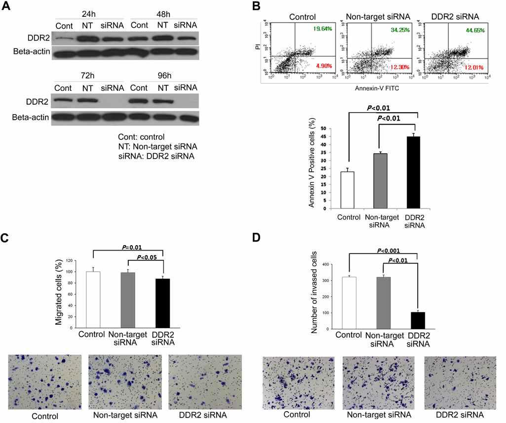 The mechanism involved in the DDR2 siRNA-induced inhibition of SNU182 tumor growth. (A) Expression of DDR2 in SNU182 cells was completely abrogated after 72 h of DDR2 siRNA treatment, and was not affected by non-target siRNA or PBS control. (B) The apoptosis analysis demonstrated that DDR2 siRNA treatment significantly increased apoptotic cells (P < 0.01). (C) Cell migration was significantly inhibited by DDR2 siRNA treatment (P < 0.05). (D) Cell invasion was dramatically decreased by DDR2 siRNA treatment, in comparison with non-target siRNA treatment or PBS control (P < 0.01).