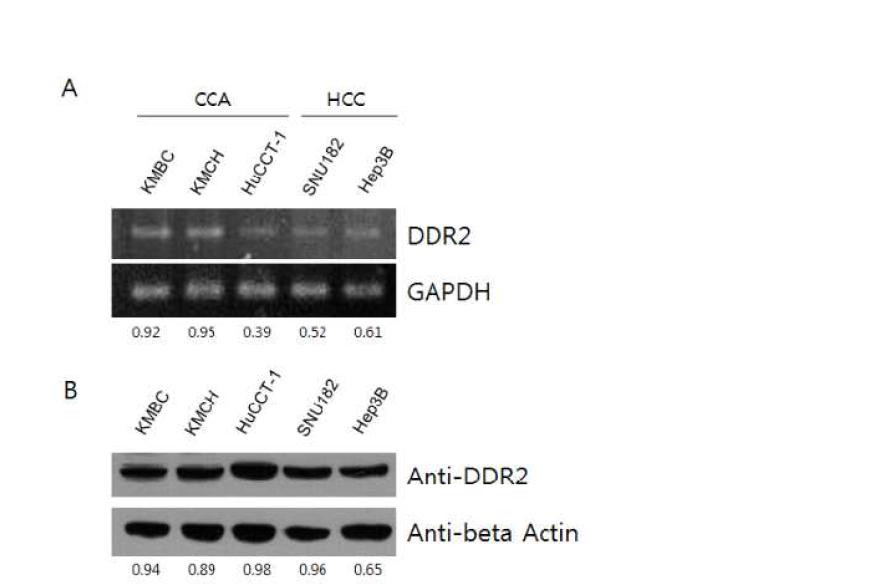 Cholangiocarcinoma(CCA)와 Hepatocytocarcinoma(HCC)에서 DDR2의 발현. RT-PCR으로 확인한 mRNA expression(A), Western blot을 이용한 protein expression(B)