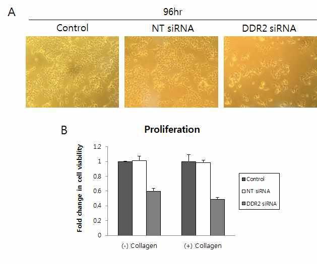 DDR2 siRNA 처리에 의한 세포 증식 억제. siRNA Transfection 후 96시간 배양했을 때 세포 사진(40배율, Olympus)(A), Collagen coating 유무에 따른 DDR2 siRNA의 세포 증식 억제 효과(B) DDR2 depletion