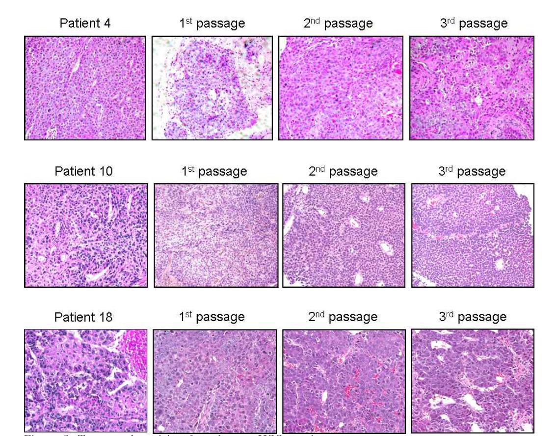 Tumorgrafts arising from human HCC specimens Representative H histologic characteristics of Avatars are similar to the source tumors of patient.