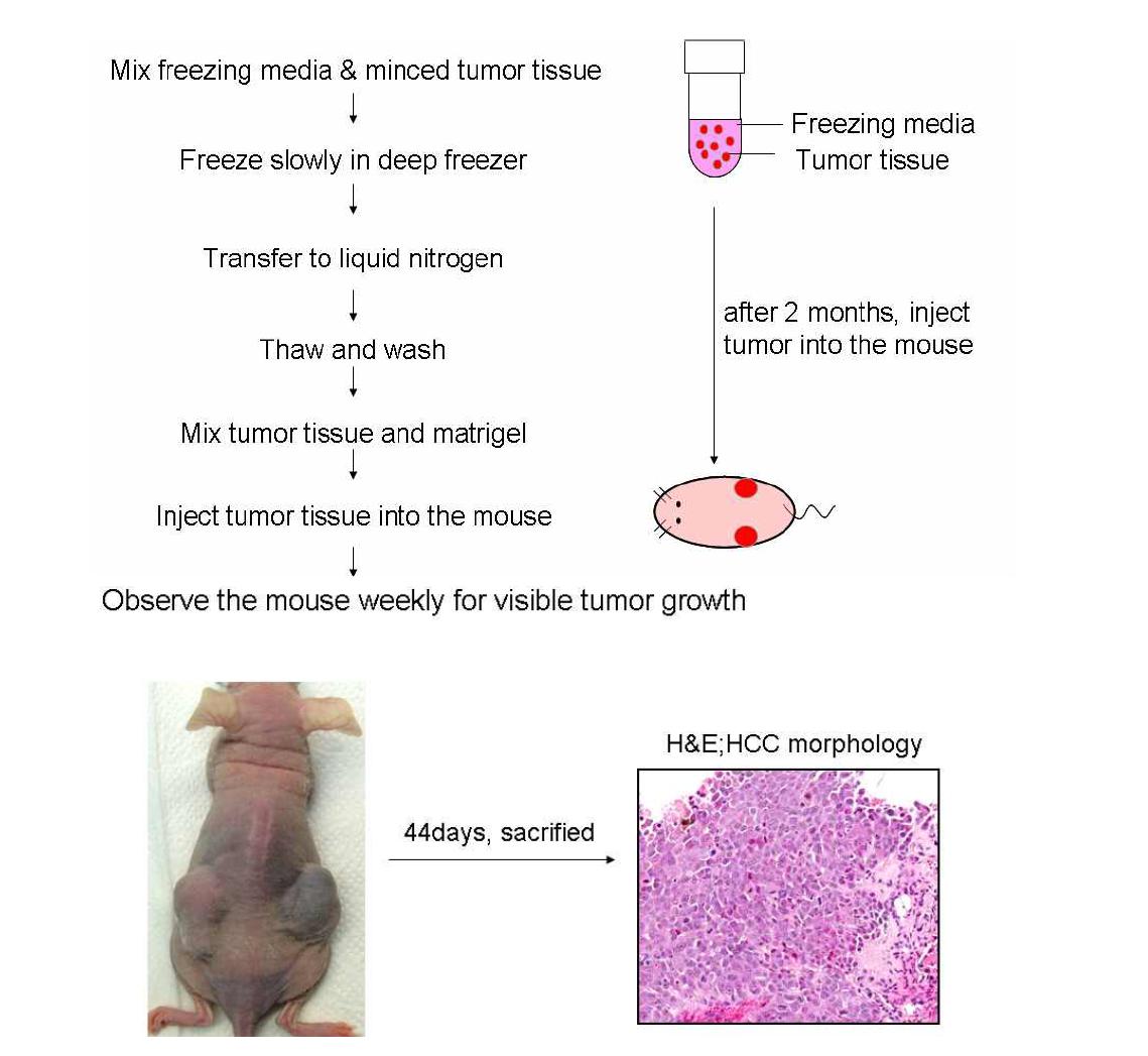 Cryopreservation of tumorgraft tissue