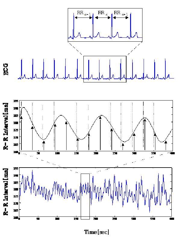 심전도와 RRI의 개념도