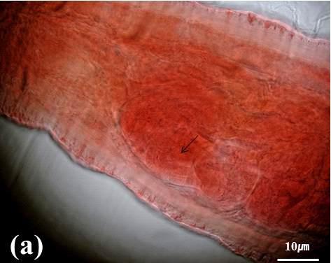 Fridericia sp. (a) Spermathecal ampulla