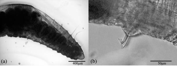 Tubifex tubifex a. anteriorpart(x100), b.ventral bundle of X(x400)