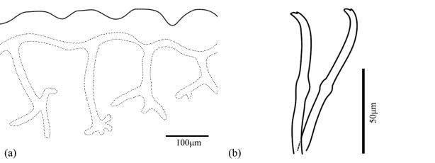 Limnodrilus claparedeianus