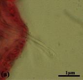 Nais pseudobtusa Piguet, 1906 (a) Anterior ventral chaeta