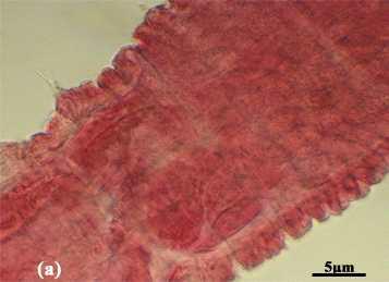 Marionina sp. (a) Spermathecal ampulla