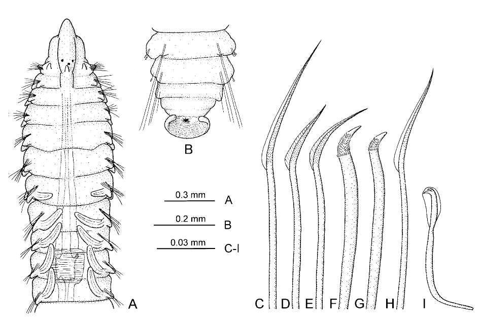 Pseudopolydora gigeriosa sp. nov.