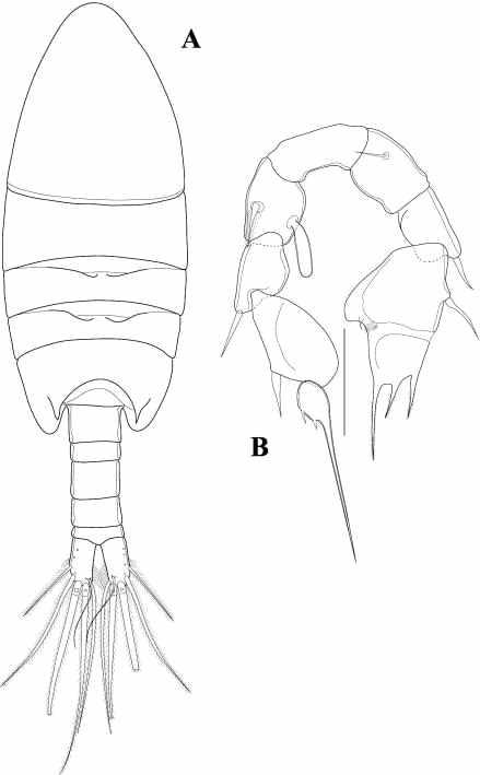 Paramisophria n. sp. 3.