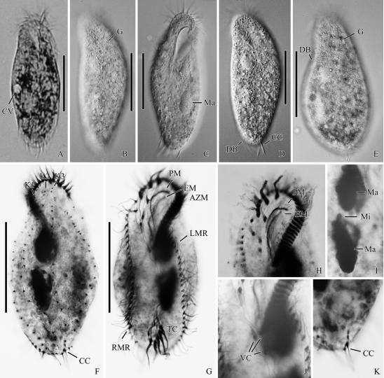 Pseudocyrtohymena koreana n. sp.