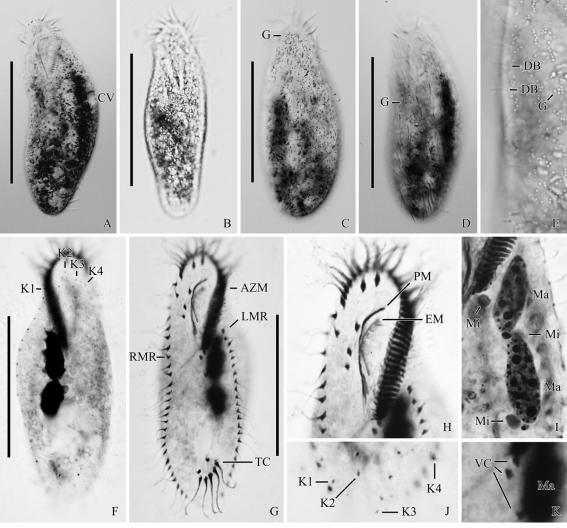 Pseudocyrtohymena lacuna n. sp