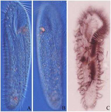 Oxytricha ganghwaenesis n. sp. from live and after protargol impregnation.