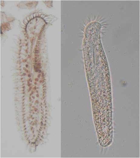 Holosticha n. sp. ventral view of Protargol impregnated and live specimens.