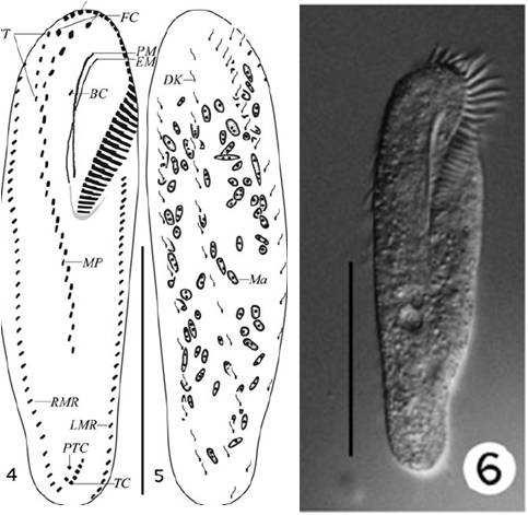 Anteholosticha multicirrata n. sp. ventral view of Protargol impregnated and live specimens