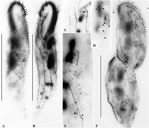 Pseudouroleptus jejuensis n. sp. ventral and dorsal view of Protargol impregnated specimens.