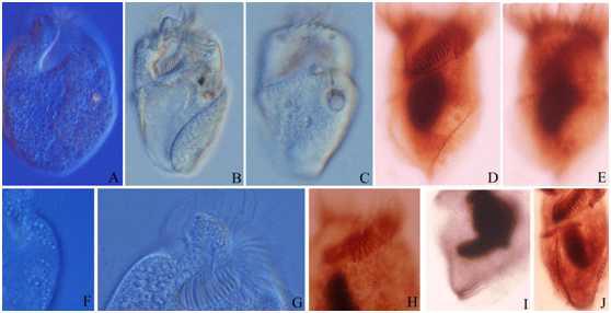 Parallelostrombidium paralatum.