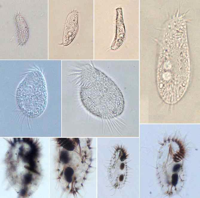 Morphology of Tachysoma dragescoi Song & Wilbert, 2001 from life and after protargol impregnation.