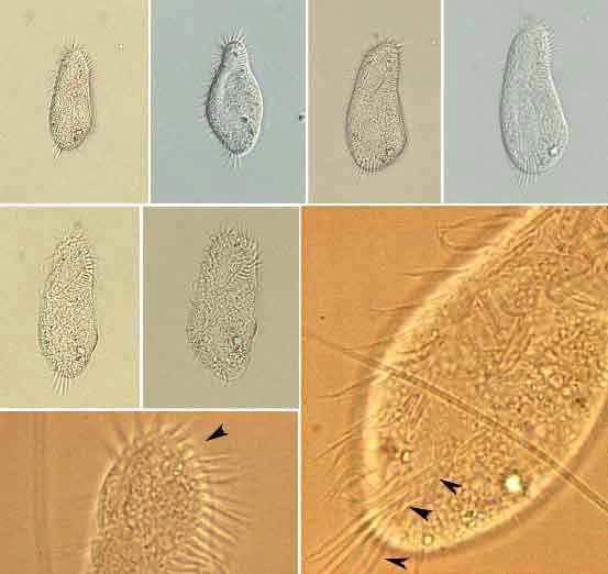 Morphology of Holosticha diademata Song & Wilbert, 2001 from life and after protargol impregnation.