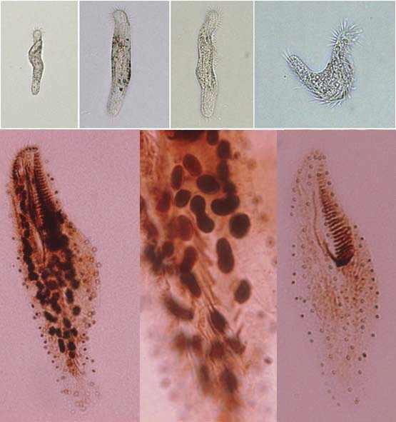 Morphology of Holosticha bradburyae Gong et al., 2001.