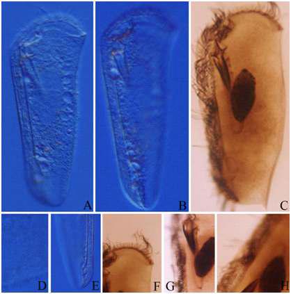 Dysteria brasiliensis Faria et al., 1922 from live and after protargol impregnation.