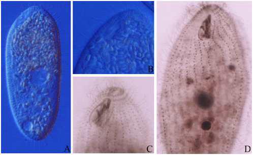 Paratetrahymena wassi Thompson, 1963 from live and after protargol impregnation.