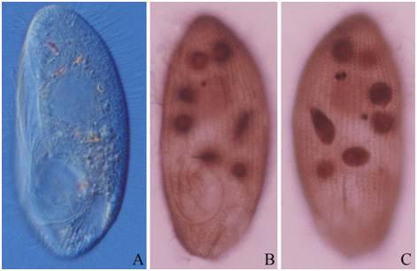 Pleuronema coronatum Kent, 1881 from live and after protargol impregnation.