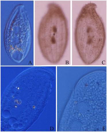 Loxophyllum sp. from live and after protargol impregnation.