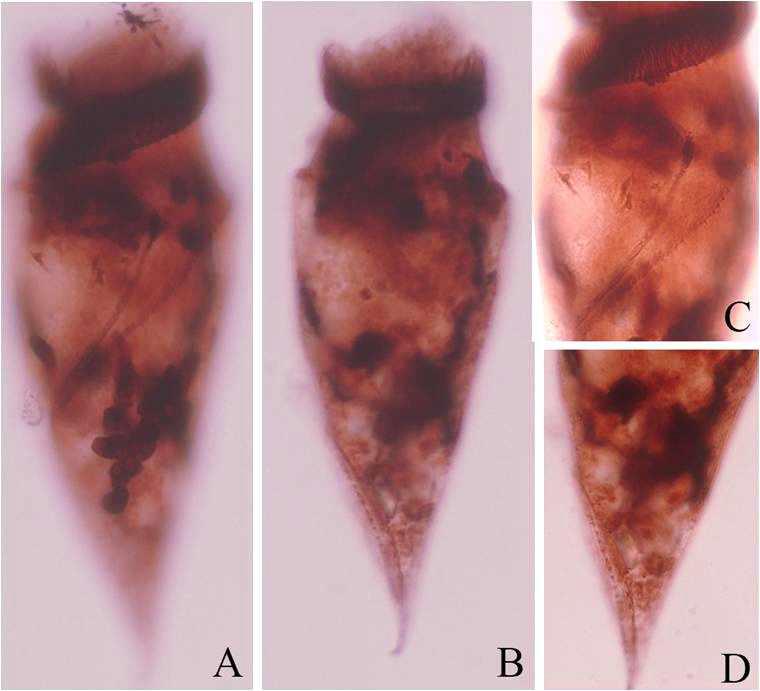 Morphology of Omegastrombidium jankowskii Song et al. 2009 from life and after protargol impregnation