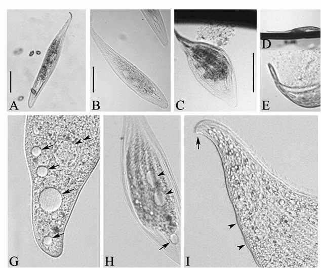 Morphology of Loxophyllum perihoplophorum from live specimens