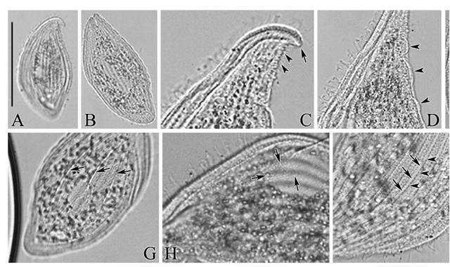 Morphology of Loxophyllum rostratum from live specimens