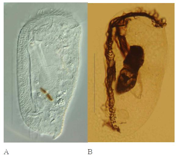 Microphotographs of Dysteria brasiliensis life (A) and after protargol impregnation (B).