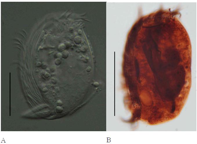 Microphotographs of Dysteria lanceolata life (A) and after protargol impregnation (B).