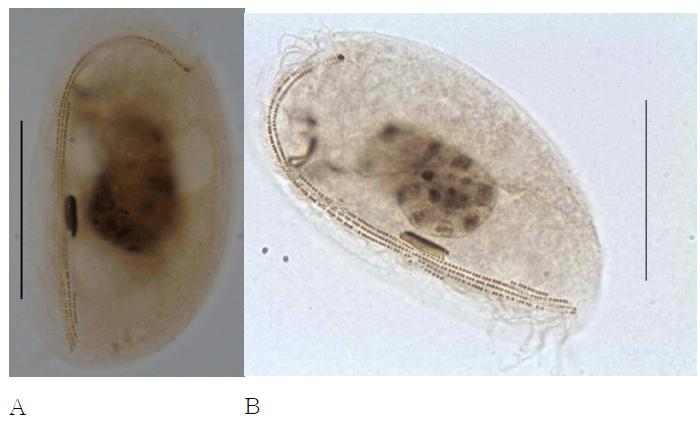 Microphotographs of Dysteria brasiliensis after protargol impregnation (A and B).