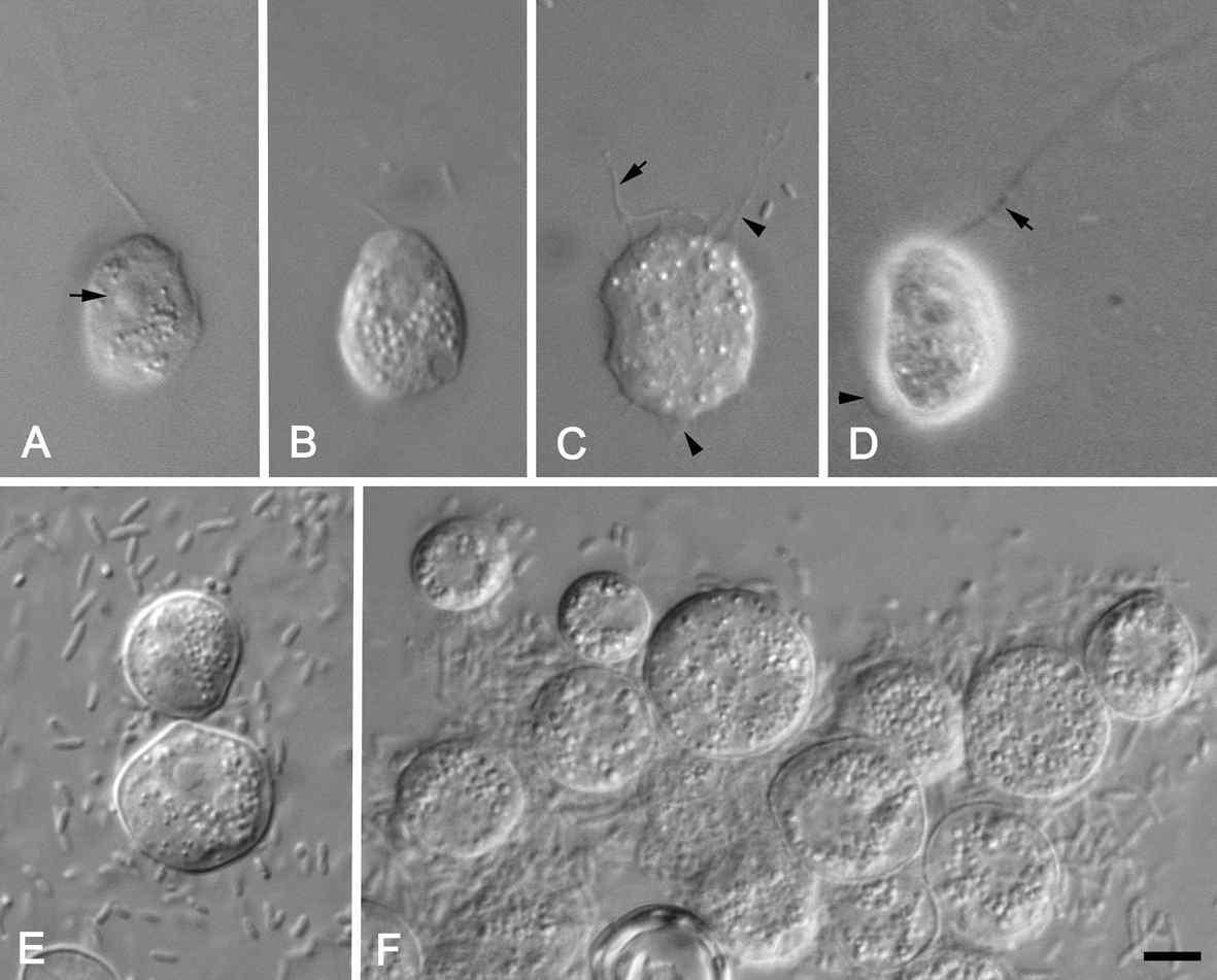 Cercomonas plasmodialis